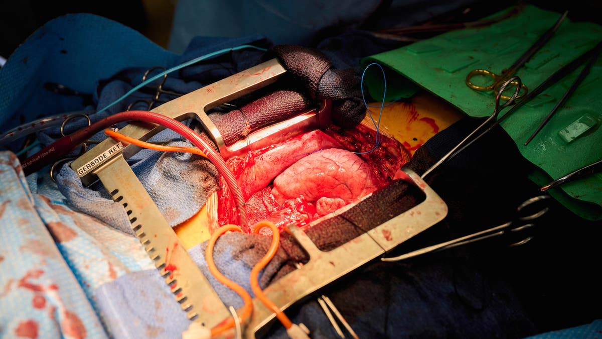 pig heart transplant medical research