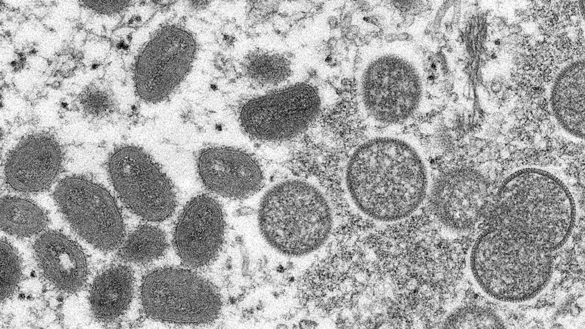 Monkeypox virus under a microscope