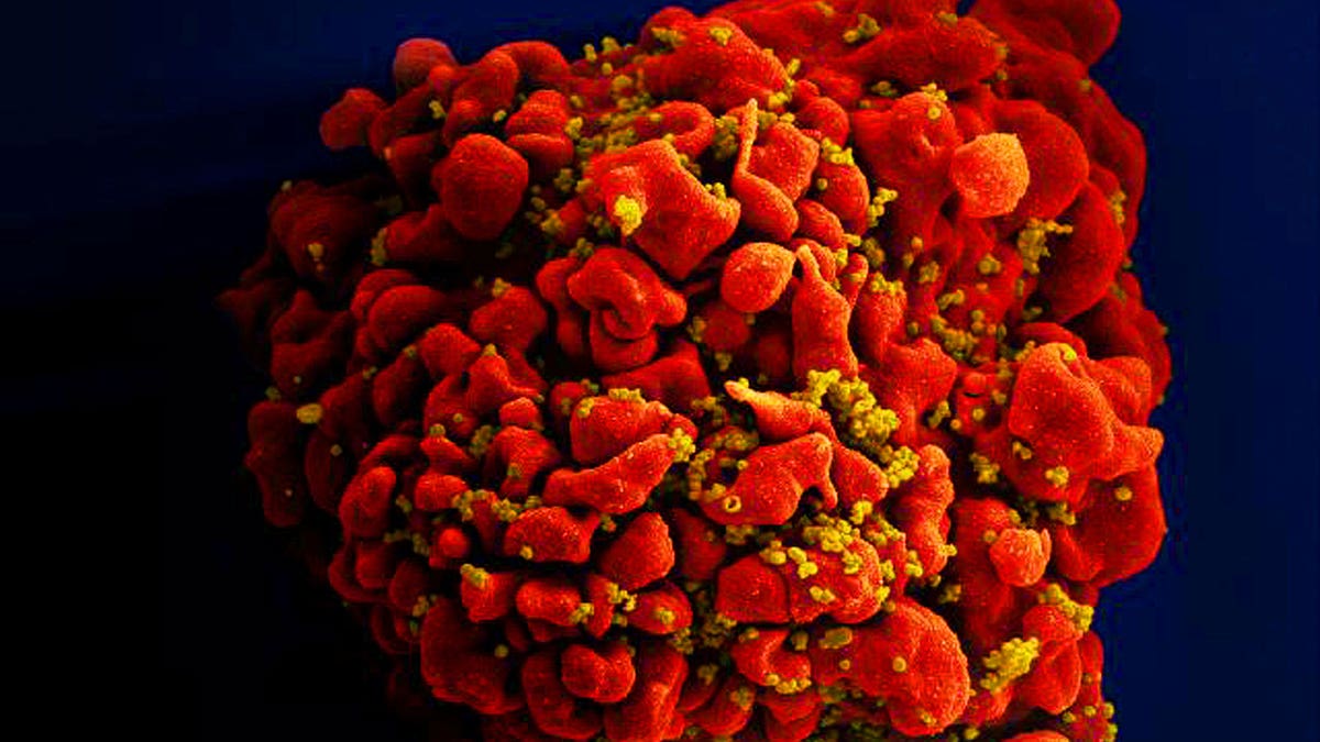 H9-T cell infected with HIV particles