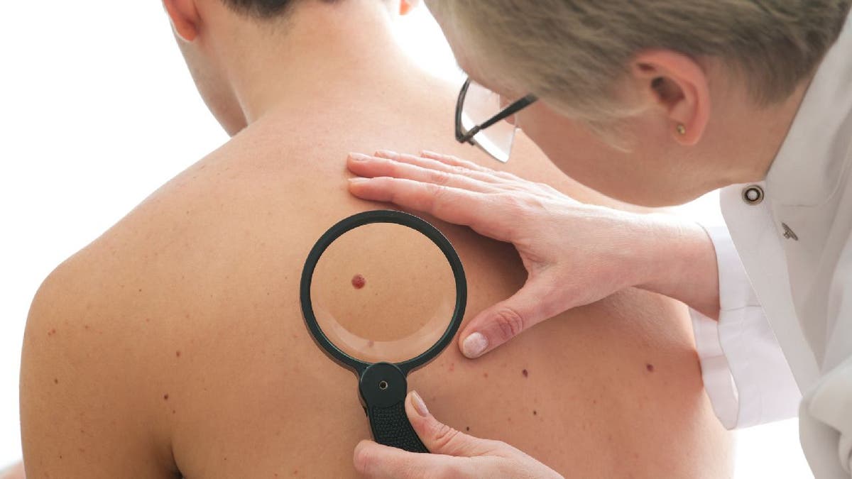 Man getting skin checked by doctor