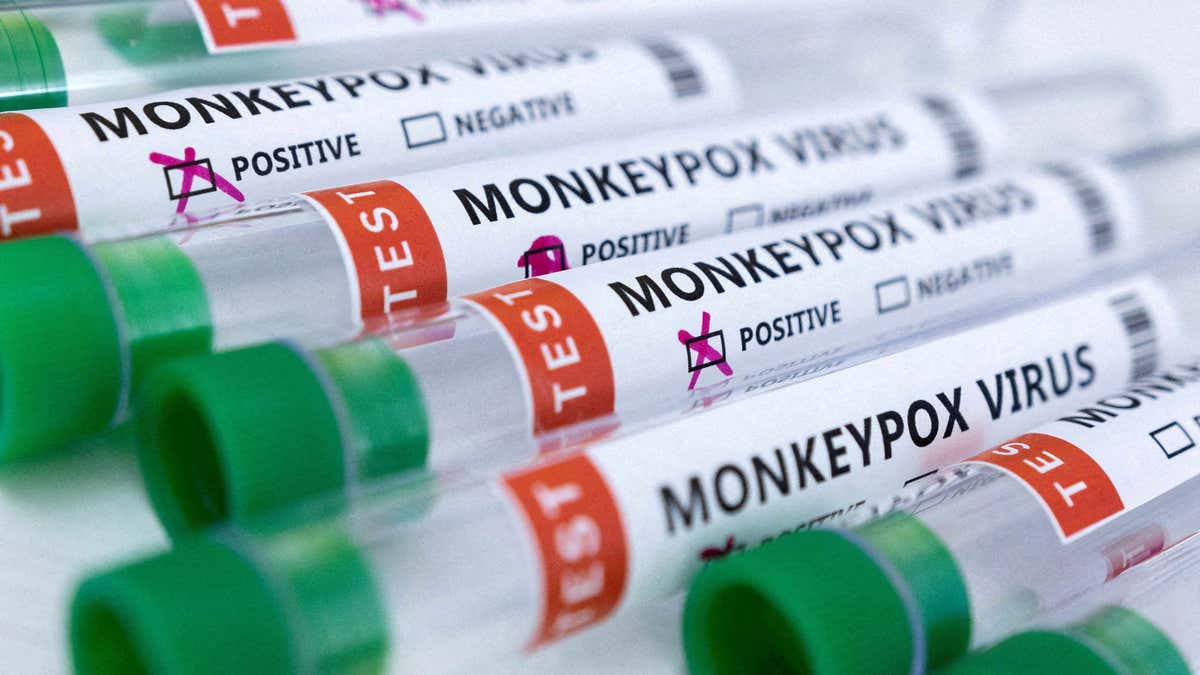 Vials of Monkeypox positive and negative results