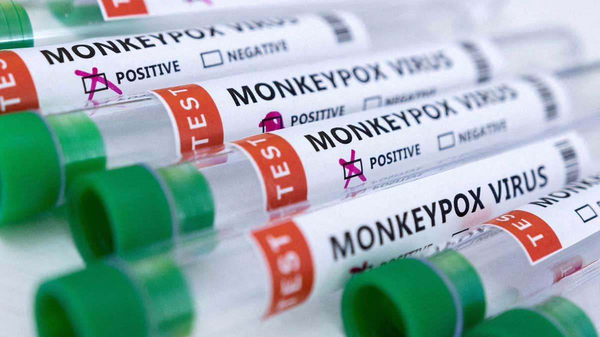 Vials of Monkeypox positive and negative results 