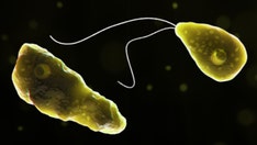 Nebraska child dead from suspected brain-eating amoeba