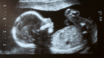 Democrat governor goes all-in on abortion rights, kneecaps funding to pro-life centers