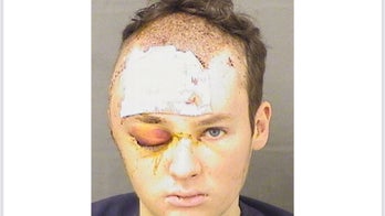 Florida suspect shot by police after allegedly holding therapist hostage