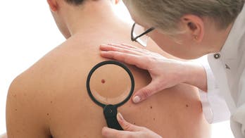 Men's skin cancer deaths are higher than women's: New analysis