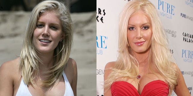 Heidi Montag has already undergone 10 operations on the same day.