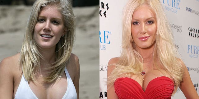 Heidi Montag once had 10 procedures on the same day.