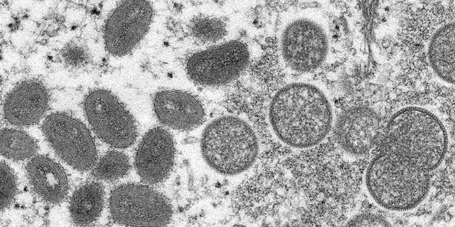 Mature, oval-shaped monkeypox virions, left, and spherical immature virions, right, taken by an election microscope in 2003.