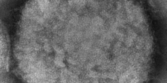 This 2003 electron microscope image made available by the U.S. Centers for Disease Control and Prevention shows a monkeypox virion, obtained from a sample associated with the 2003 prairie dog outbreak. 