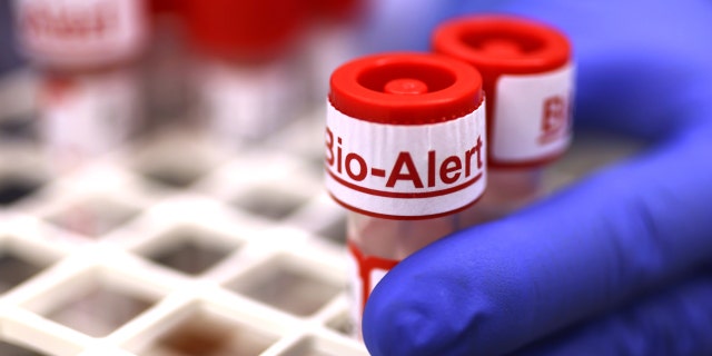 The top of a swab specimen containing Monkeypox virus is labeled "Bio Alert at the UW Medicine Virology Laboratory on July 12, 2022 in Seattle.