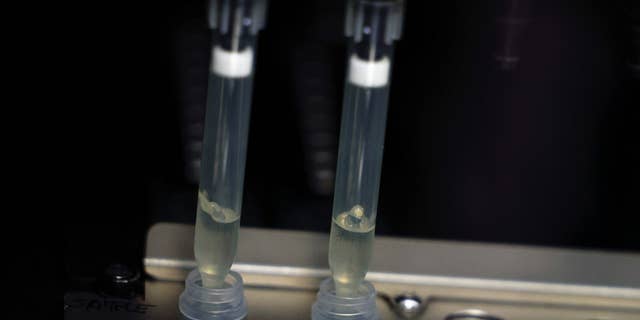 Two samples suspected of having monkeypox are tested in a microbiology laboratory at La Paz Hospital in Madrid, Spain, June 1, 2022.
