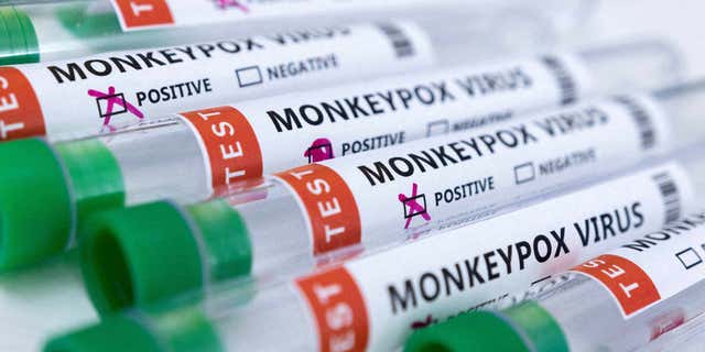 Tubes labeled "Monkeypox Virus," with positive and negative results pictured, in this illustration taken May 23, 2022.