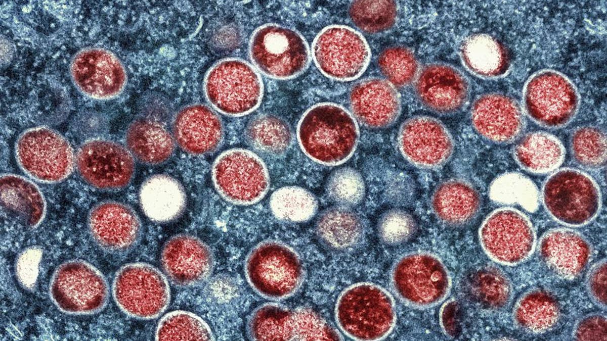 Monkeypox color-enhanced micrograph