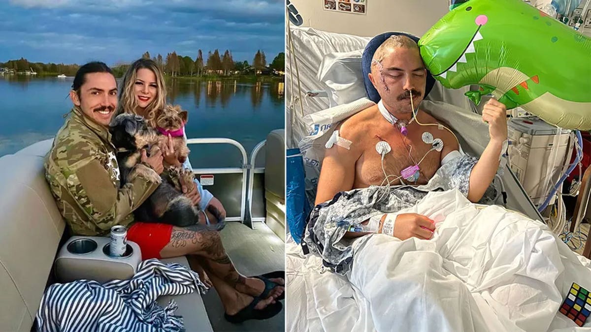 Before and after photographs of alligator attack victim JC Defeats