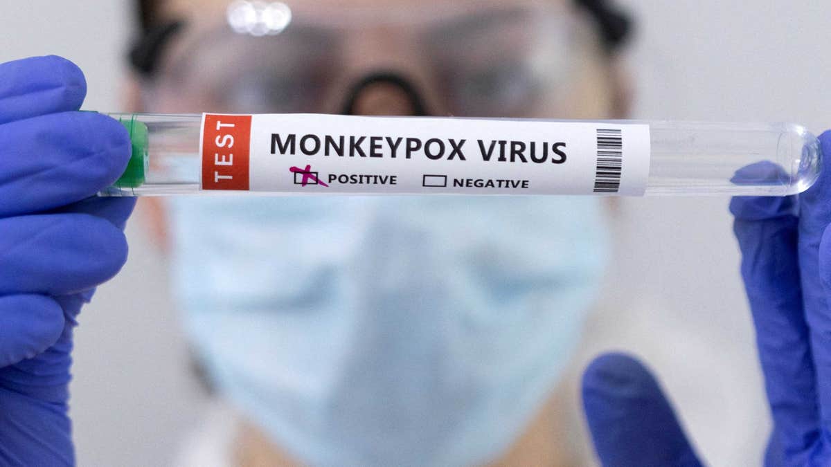 Positive monkeypox samples