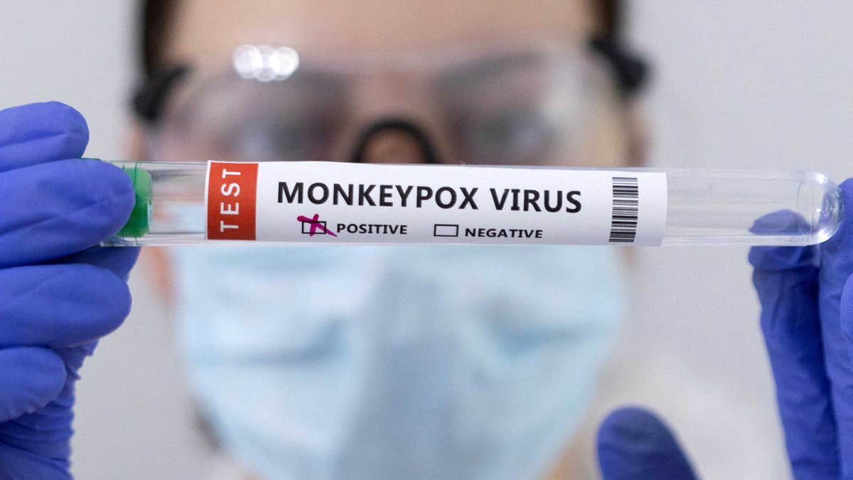 Positive monkeypox samples