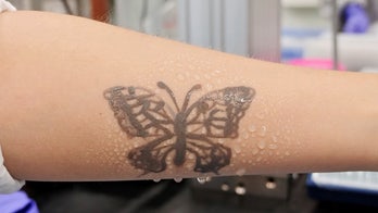 South Korea develops electronic tattoo that can alert patients to possible health problems