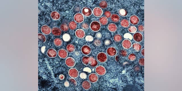 This image provided by the National Institute of Allergy and Infectious Diseases (NIAID) shows a colorized transmission electron micrograph of monkeypox particles (red) found within an infected cell (blue), cultured in the laboratory that was captured and color-enhanced at the NIAID Integrated Research Facility (IRF) in Fort Detrick, Md.