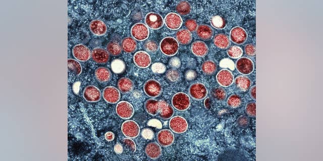 This image provided by the National Institute of Allergy and Infectious Diseases (NIAID) shows a color transmission electron micrograph of monkeypox particles (red) found in an infected cell (blue) cultured in the laboratory, which were captured and color enhanced at NIAID.  Integrated Research Facility (IRF) at Fort Detrick, Maryland.