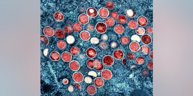 This image provided by the National Institute of Allergy and Infectious Diseases shows a colorized transmission electron micrograph of monkeypox particles (red) found within an infected cell (blue), cultured in the laboratory that was captured and color-enhanced at the NIAID Integrated Research Facility in Fort Detrick, Md.  