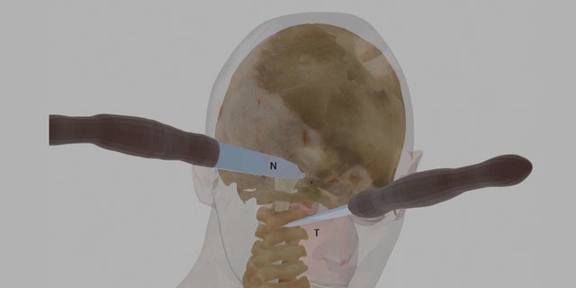 A computer illustration showing two of Ellen Greenberg's knife wounds to the back of her neck and skull.