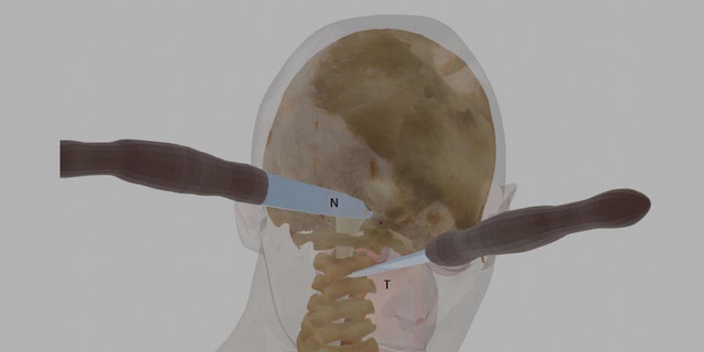 A computer illustration showing some of Ellen Greenberg's knife wounds