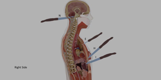 A computer illustration showing four of Ellen Greenberg's knife wounds to her head and torso.