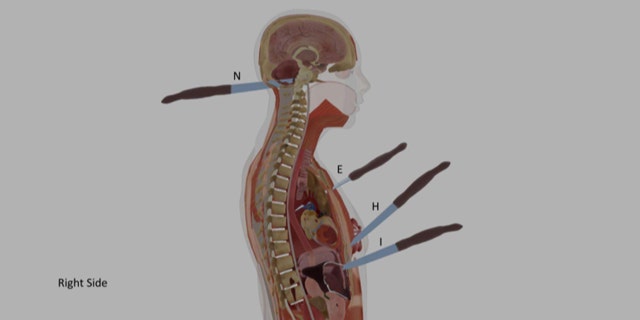 A computer illustration showing some of Ellen Greenberg's knife wounds