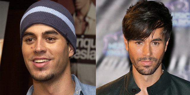 Enrique Iglesias had a mole removed under his right eye in 2003.