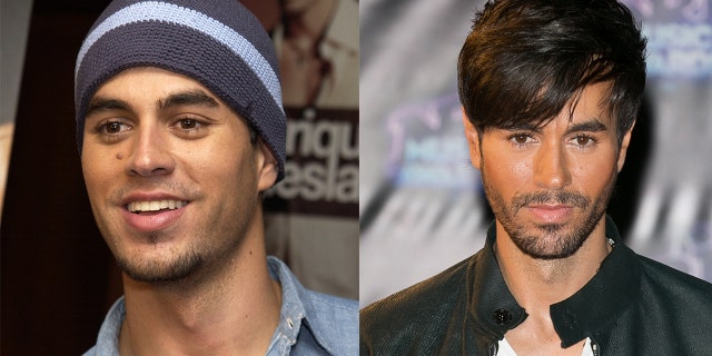Enrique Iglesias had a mole removed under his right eye in 2003.