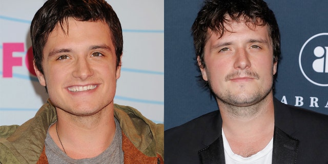 Josh Hutcherson had a nose job in 2012.
