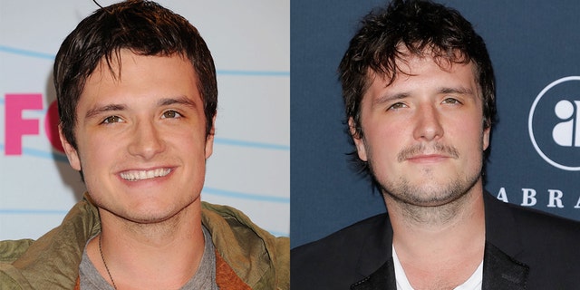 Josh Hutcherson had a nose job in 2012.