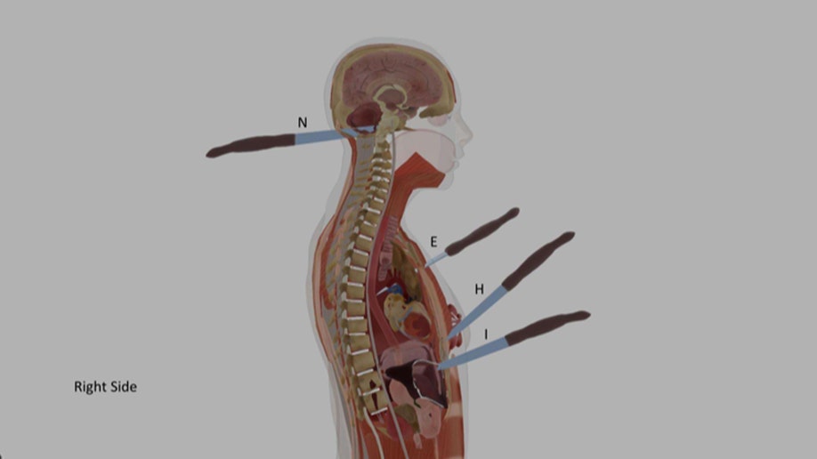 A computer illustration showing some of Ellen Greenberg's knife wounds