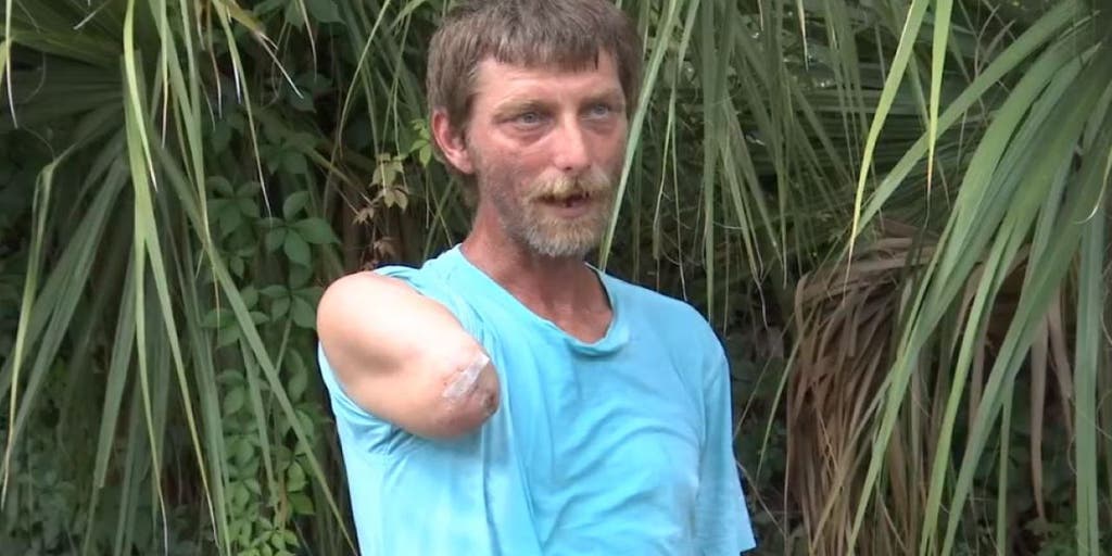 Florida man survives 3 days in swamp after losing arm in alligator attack: 'Do or die' - Vimarsana News