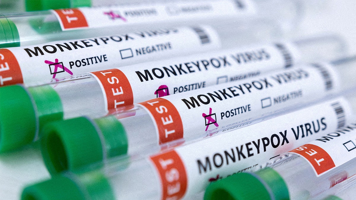 Monkeypox Virus