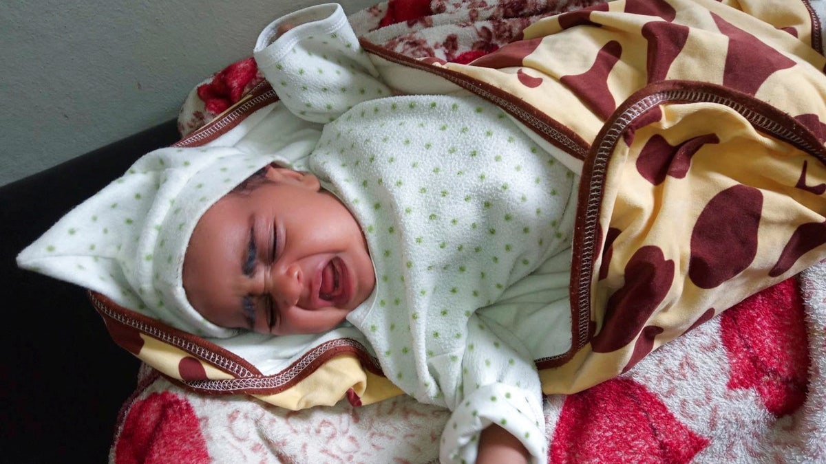 Child with whooping cough