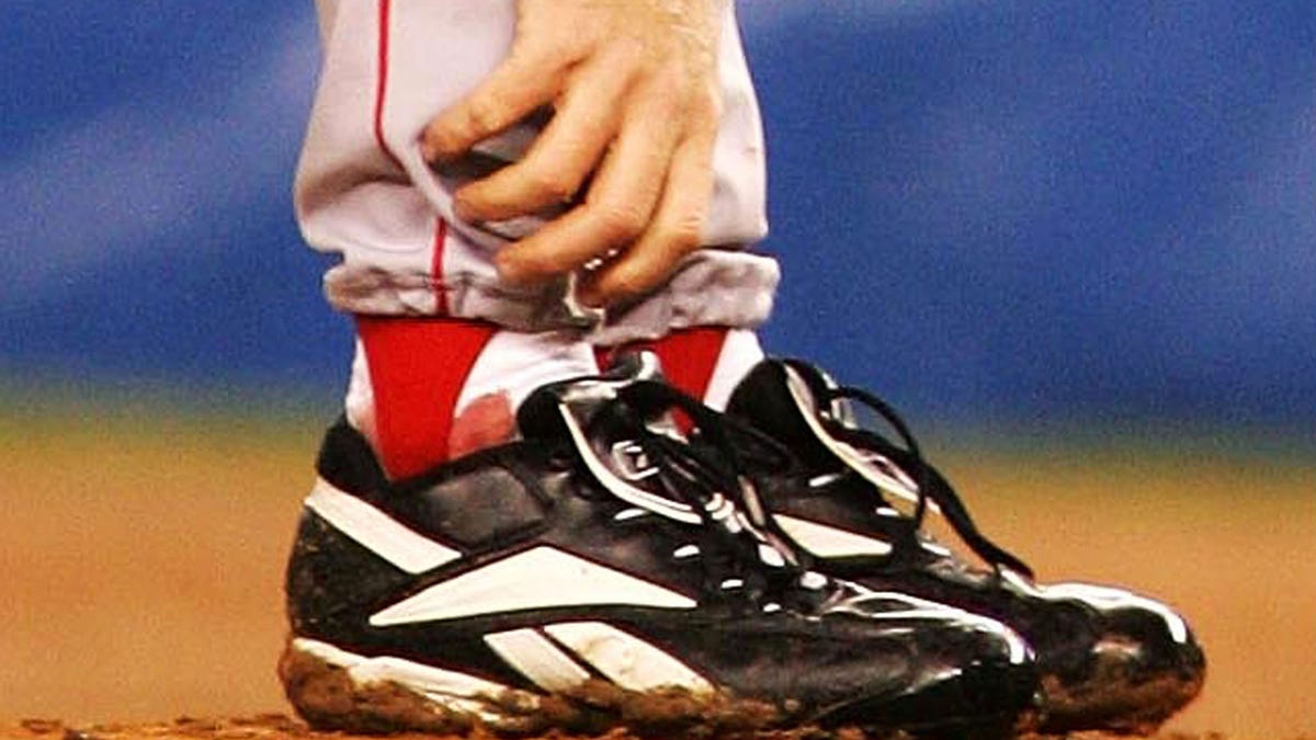 Up-close look at Curt Schilling's bloody ankle