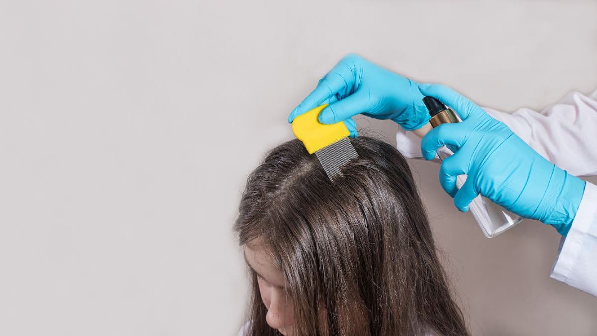 Kids with head lice don't need to leave school: report