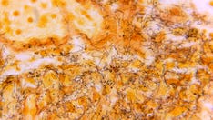 ‘Out of control’ STD situation prompts call for changes