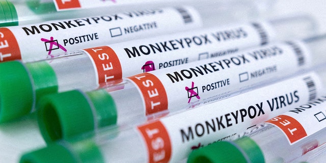 Test tubes labeled "Monkeypox virus positive and negative" are seen in this illustration taken May 23, 2022.