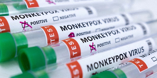 Test tubes labeled "Monkeypox virus positive and negative" are seen in this illustration taken May 23, 2022.