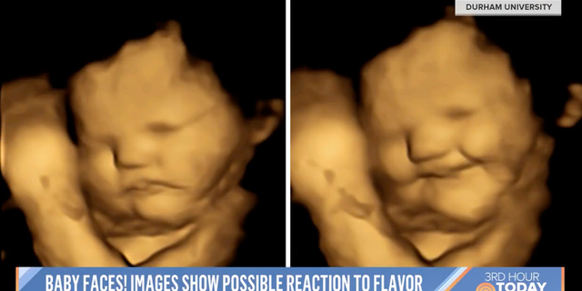 Conservatives were stunned when NBC "Today" referred to "babies in the womb" on Thursday.