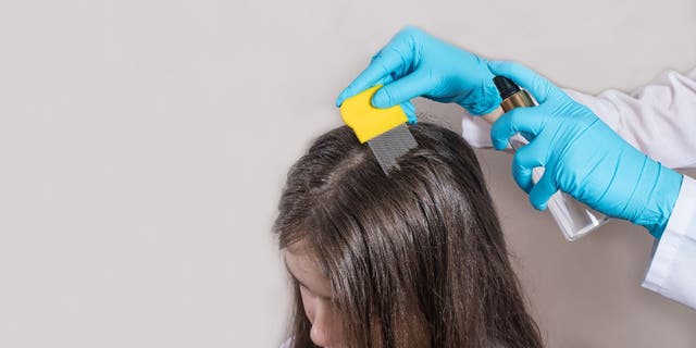 A child is treated for lice in this stock image.