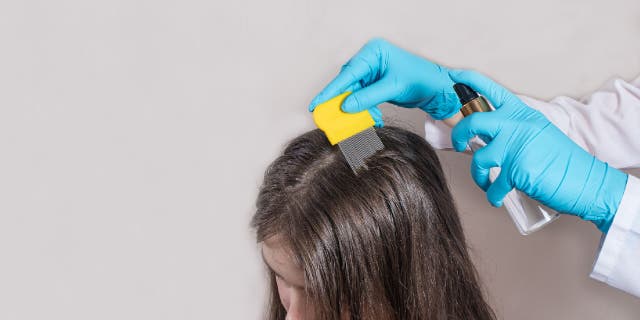 A child is treated for lice in this stock image.
