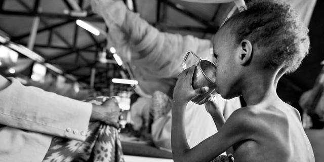 A Somali child severely malnourished is seen at the Medecins Sans Frontieres hospital in the Dagahaley refugee camp on Aug. 20, 2011. 