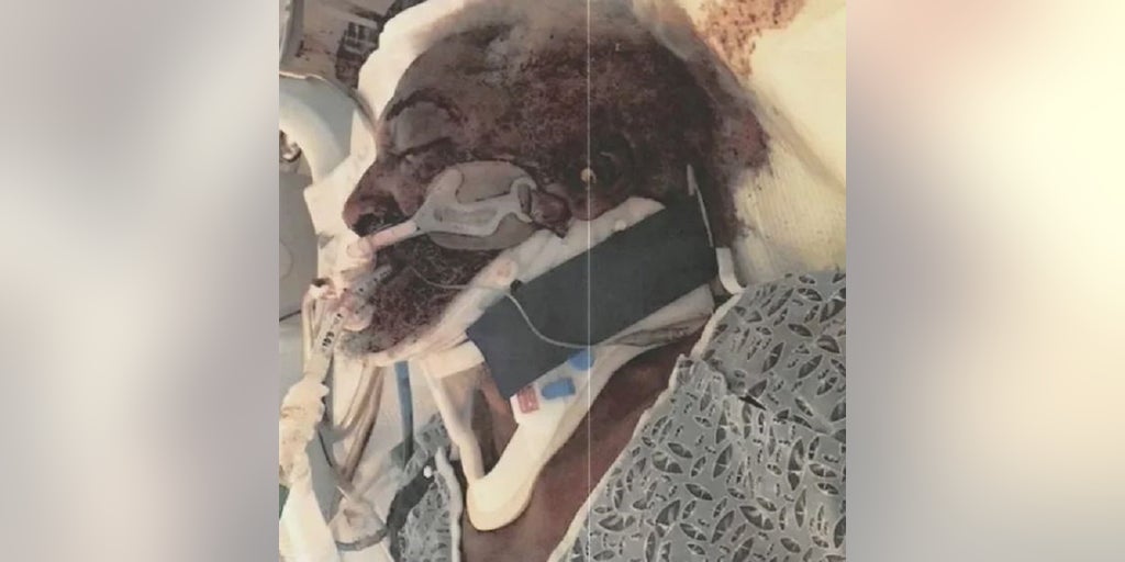 Homeless Atlanta man expected to receive millions from being paralyzed by fall after officer Tasered him - Vimarsana News