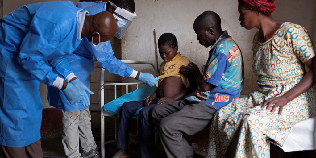 Widespread illness, deaths go unnoticed as monkeypox continues to spread in Africa - Vimarsana News