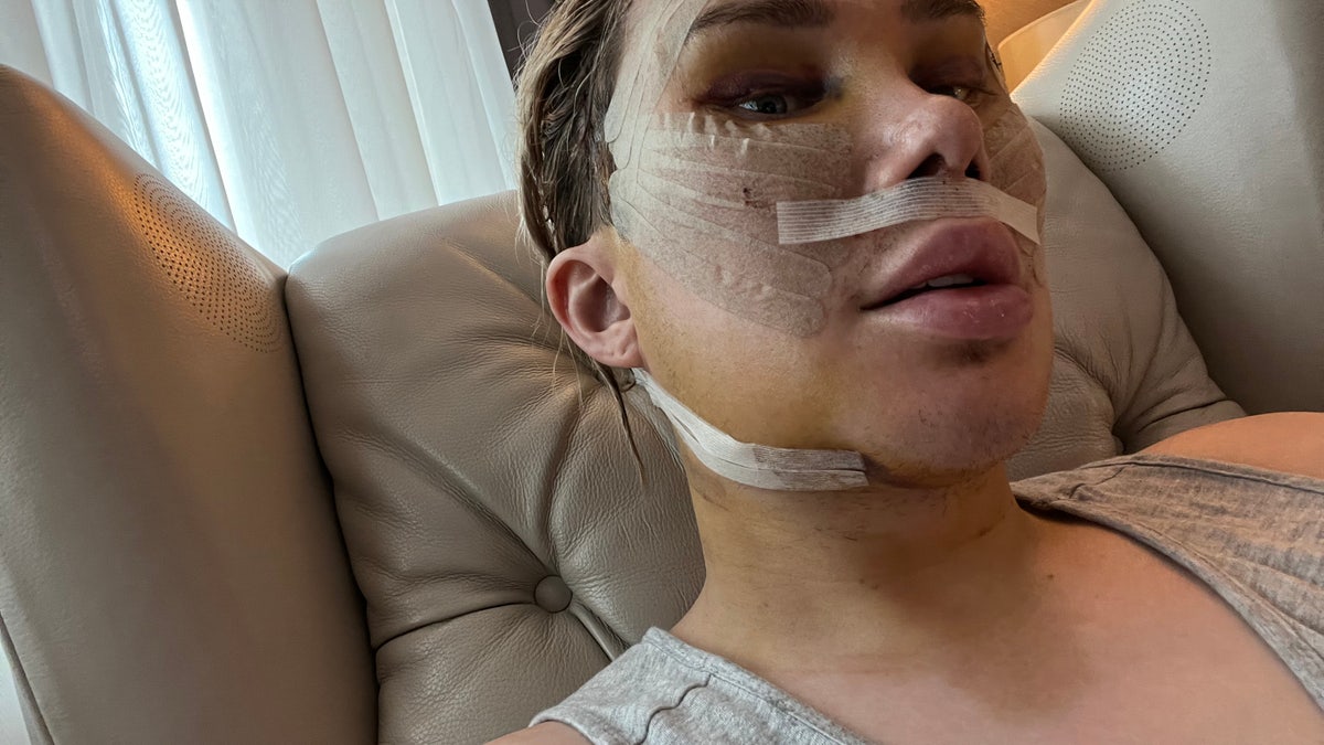 Oli London plastic surgery