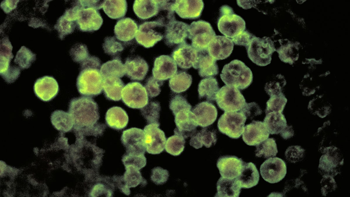 brain-eating amoeba